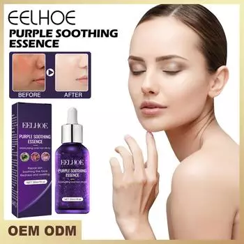 EELHOE Экстракт периллы, увлажняющая сыворотка, сужает поры, контролирует жирность эссенции для лица, отбеливает, осветляет, удаляет морщины, укрепляющие продукты 30ml