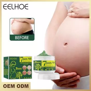 Eelhoe крем для удаления растяжек, восстанавливающий шрамы для беременных, укрепляющие средства для ухода за кожей беременных, 10 г/30 г/50 г 30g boxed