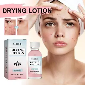 EELHOE Мгновенное средство для удаления прыщей Сыворотка для лица Лифтинг Фирма против старения Выцветание тонких линий Увлажняющая эссенция Отбеливание Осветляющее восстановление Уход за кожей 30ml