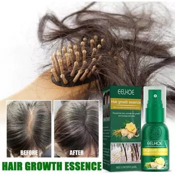 EELHOE спреи для роста волос с имбирем, натуральная сыворотка против выпадения волос, предотвращение облысения, быстрый рост, питание, уход за поврежденными волосами 30ml