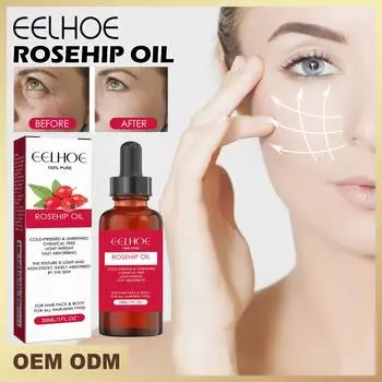 EELHOE Уход за волосами с фруктами розы Эфирное масло против роста волос Гладкая сыворотка Масло для волос против выпадения волос Новые процедуры Красота волос 30ml