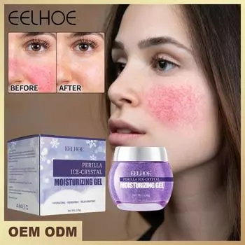 EELHOE успокаивающий гель от прыщей, восстанавливающий кожу, фиолетовый гель с периллой, уход за кожей, восстановление от солнца, акне, уход за лицом, красота, здоровье, увлажняющий, 120 г 120g