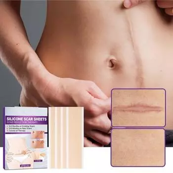 Fade C-section Smooth Skin Силиконовый пластырь для ухода за кожей