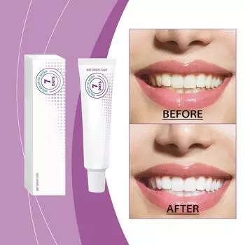 Фиксирующий клей для зубных протезов Мягкий клей для зубных протезов Клей для зубных протезов длительного действия One Size