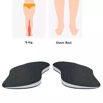 Foot Knock Knee Pain Unisex Leather O/X Leg Orthopedic Insoles Bow Legs Valgus Varus Shoes Pad Correction Shoe Inserts Men Women 35-36 чёрный