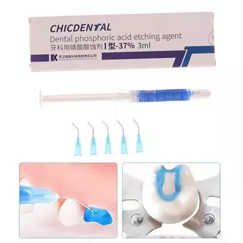 Гель для травления зубов 37% фосфорная кислота Гель для травления зубов Протравливающий агент Стоматологический ортодонтический клей Светоотверждаемый бонд для зубов
