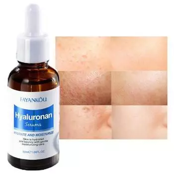 Гиалуроновая кислота увлажняющая эссенция против морщин удаление веснушек нежная кожа и отбеливающая эссенция для ухода за лицом