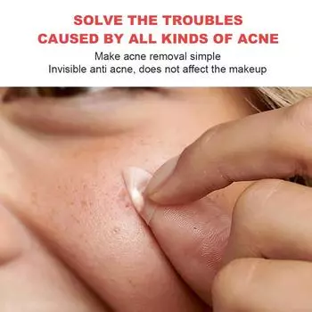 Гидроколлоидный пластырь от прыщей и угрей для маскировки прыщей и пятен на лице и коже - 72/108/144Count 72conut