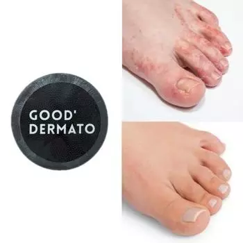 Good Dermato Мыло для ног и ногтей Mediclear 115 г (Очищает и устраняет мозоли/запах/влагу/корку между пальцами ног), 1 единица