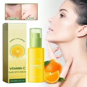 Green Tangerine VC Легкое отбеливание, осветление, увлажнение, исчезновение пятен от прыщей, оранжевый, 30 мл One Size