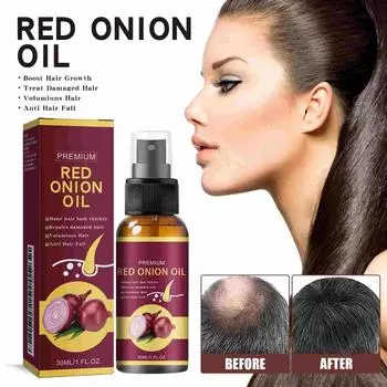 Hair Growth Oil, Масло для роста волос, питает кожу головы, улучшает кровообращение, зуд и сухость кожи головы, 30мл One size белый