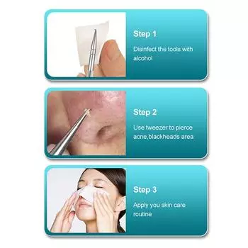 Инструмент для удаления черных точек, средство от прыщей, иглы для удаления прыщей, пинцет, очиститель пор, инструмент для глубокой очистки