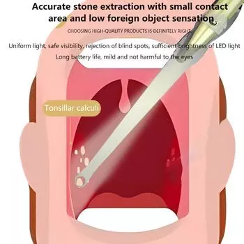 Инструмент для удаления камней из миндалин Светодиодный светильник для удаления камней из миндалин Инструменты для чистки полости рта из нержавеющей стали