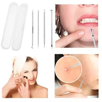 Инструмент для удаления прыщей на лице из нержавеющей стали, комедон серебряный