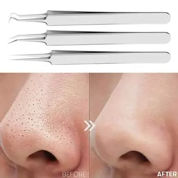 Инструмент для удаления угрей Пинцет из нержавеющей стали для удаления угрей для чистой кожи Пинцет для удаления угрей с противоскользящей ручкой Инструмент для извлечения угрей 4pcs