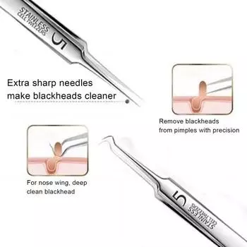 Инструмент для удаления угрей Пинцет из нержавеющей стали для удаления угрей для чистой кожи Пинцет для удаления угрей с противоскользящей ручкой Инструмент для извлечения угрей 4pcs