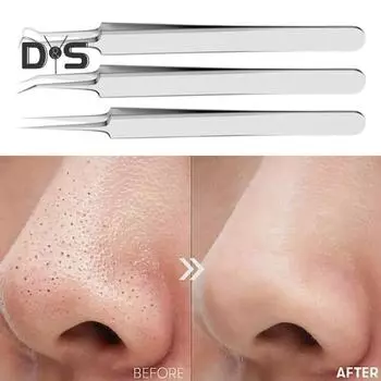 Инструмент для удаления угрей Пинцет из нержавеющей стали для удаления угрей для чистой кожи Пинцет для удаления угрей с противоскользящей ручкой Инструмент для извлечения угрей 4pcs