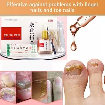 Инструменты для ногтей Инструменты для ногтей Модная эссенция для ремонта ногтей Увлажняющий художественный уход Питание для сухой потрескавшейся кутикулы Уход за ногтями Инструменты для ногтей