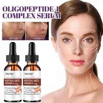 Эффективно осветляет крем для лица, удаляет хлоазму, прыщи, пигмент, черные пятна, средство для ухода за кожей с пигментацией 5ml