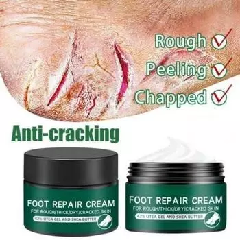Эффективное лечение запаха питательный крем против трещин средства по уходу за кожей удаление омертвевшей кожи потрескавшийся восстанавливающий крем 5G