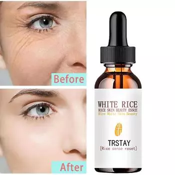 Эффективное отбеливание кожи против морщин, крем для лица, эссенция для глаз, удаление крема aclaradora de piel 5ml