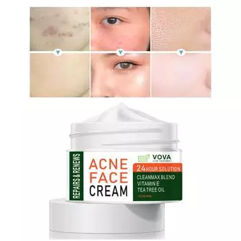 Эффективный крем для удаления прыщей, лечение прыщей, исчезновение пятен от прыщей, контроль жирности, сужение пор, отбеливание, увлажняющий крем от прыщей, уход за кожей 30g