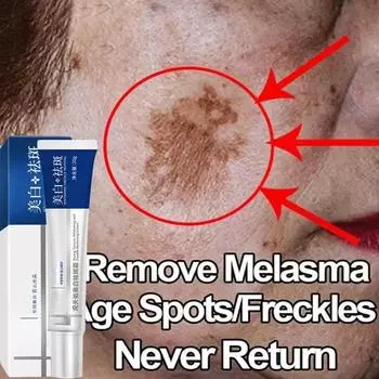 Эффективный отбеливающий крем от веснушек, удаление мелазмы, темных пятен, устранение пигментации, увлажнение, осветление кожи лица, средство по уходу за кожей