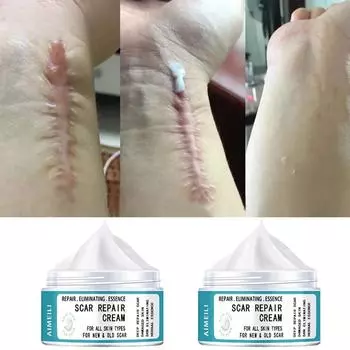 Эфирное масло для удаления шрамов, ультрапремиум-комплексные эфирные масла для массажа, ухода за кожей лица, тела, восстановления шрамов, прыщей, ожогов 5g