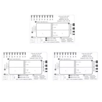 ЭКГ 7-ступенчатая линейка 7-ступенчатая шкала измерительный инструмент линейка для интерпретации ЭКГ 1mm