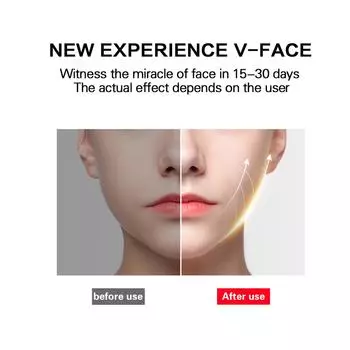 Электрический V-образный аппарат для лица Anself, устройство для подтяжки лица, умный V-образный массажер для формирования лица, подбородок V-Line Up белый