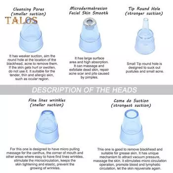Электрический вакуумный экстрактор угрей и комедонов TBH для удаления черных точек Очиститель пор лица белый