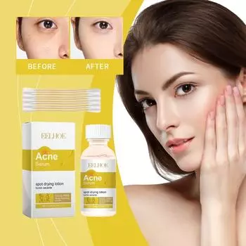 Эссенция для лица Уход за кожей лица Угревая сыпь Мышцы Закрытие угрей Мягкое очищение кожи лица Эссенция для лица
