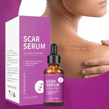 Эссенция для восстановления шрамов, уменьшающая цвет шрамов от угревой сыпи, увлажняющая сыворотка для ухода за кожей, устраняющая шрамы 1PC