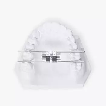 JIN GT Стоматологическая ортодонтия Спиральный удлинитель ножки Общий ортодонтический стент Ортодонтический удлинитель ножки Оральные материалы