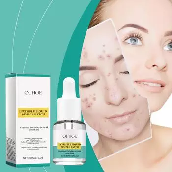 Капли для восстановления прыщей, исчезающие прыщи, прыщи и черные точки, закрытие рта, очищение пор кожи лица, эссенция 30ml