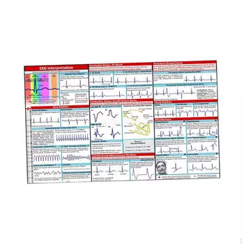 Карманный справочник ЭКГ Интерпретация ритма Обучающий дисплей Портативный Учебный Материал Основы