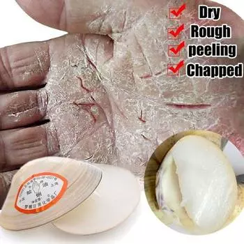 Китайская лечебная мазь для рук и ног, восстанавливающая кожу от сухости и трещин, крем с маслом моллюсков