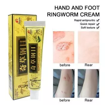 Китайский крем для ухода за ногами, массажный внешний многофункциональный для шеи и ног