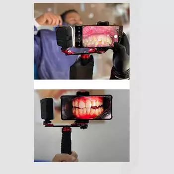 Комплект для стоматологической фотосъемки, фонарик для мобильного телефона для стоматологии, фото-видео оборудование, светильник для полости рта для стоматологов чёрный