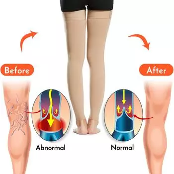 Компрессионные чулки, улучшающие кровообращение, компрессионные носки для похудения, анти-усталость, удобные однотонные носки для мужчин и женщин M бежевый