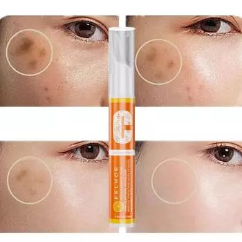 KORE LAN 1+1 Freckle Blemish Cream Эссенция для улучшения пигментации лица Тонизирующая отбеливающая, 15мл * 2, 2 шт., 15мл