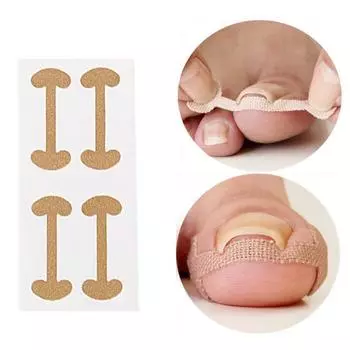 Корректор для ногтей, 4 шт., для ухода за ногтями, наклейка для лечения ногтей, коррекция, восстановление, патчи для ног, вставки для ног