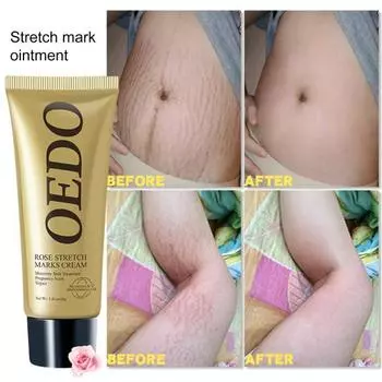 Крем Безопасные натуральные ингредиенты Экстракт розы Нежный уход за кожей беременных без аллергии 40g