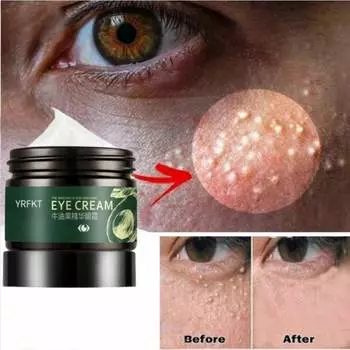 Крем для глаз от темных кругов и мешков под глазами Натуральный крем для глаз с авокадо Укрепляющий крем для глаз 5G