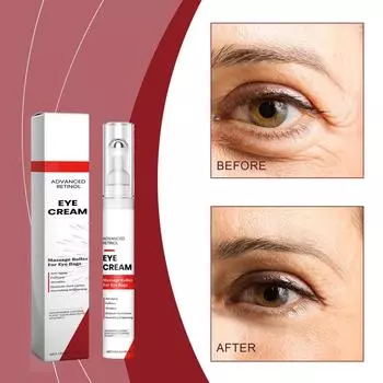 Крем для глаз с ретинолом Подтягивает, подтягивает, осветляет морщины, подтягивает кожу вокруг глаз Массажный шарик, делает глаза красивее One Size белый