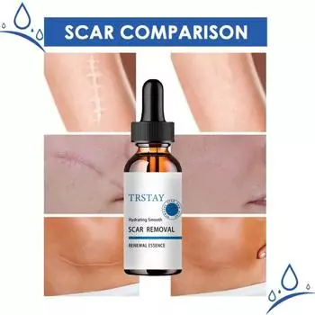 Крем для кожи, крем для ран, крем для ожогов, выцветания, хирургического восстановления, ухода за кожей шрамов, отбеливающий крем для кожи, крем для рук manchas de la cara 5ml