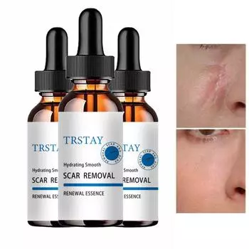 Крем для кожи, крем для ран, крем для ожогов, выцветания, хирургического восстановления, ухода за кожей шрамов, отбеливающий крем для кожи, крем для рук manchas de la cara 5ml