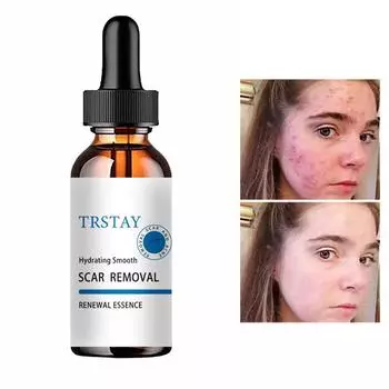 Крем для кожи, крем для ран, крем для ожогов, выцветания, хирургического восстановления, ухода за кожей шрамов, отбеливающий крем для кожи, крем для рук manchas de la cara 5ml