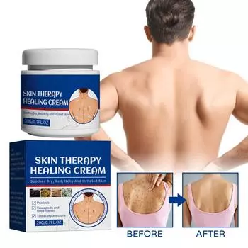 Крем для кожи от покраснений, зуда, зуда, мха кожи, мазь для местного применения 20г