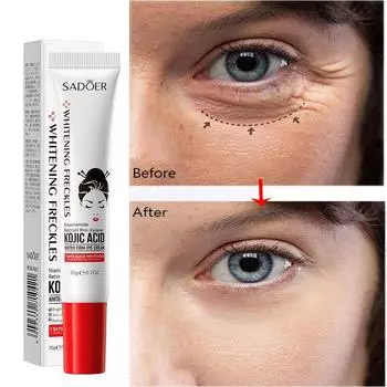 Крем для кожи вокруг глаз Fat Granules Remover, восстанавливающий защитный крем, увлажняющий, антивозрастной крем для кожи вокруг глаз, уменьшающий темные круги и отечность, уход за кожей вокруг глаз 1pc